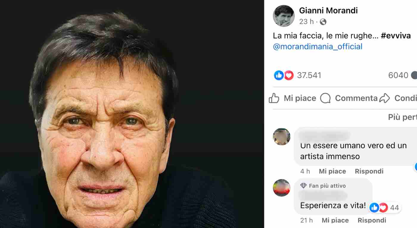 Gianni Morandi, la foto sui social che sta facendo discutere: "La mia faccia..." - Cos'è successo al cantante