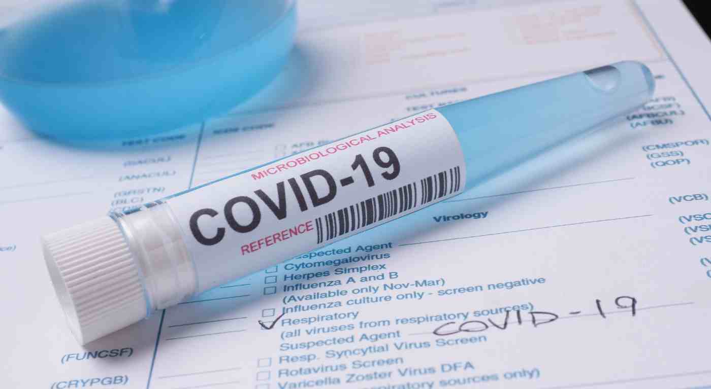 Covid, attenzione alla variante Kp3: primi sintomi e cosa fare se si è positivi