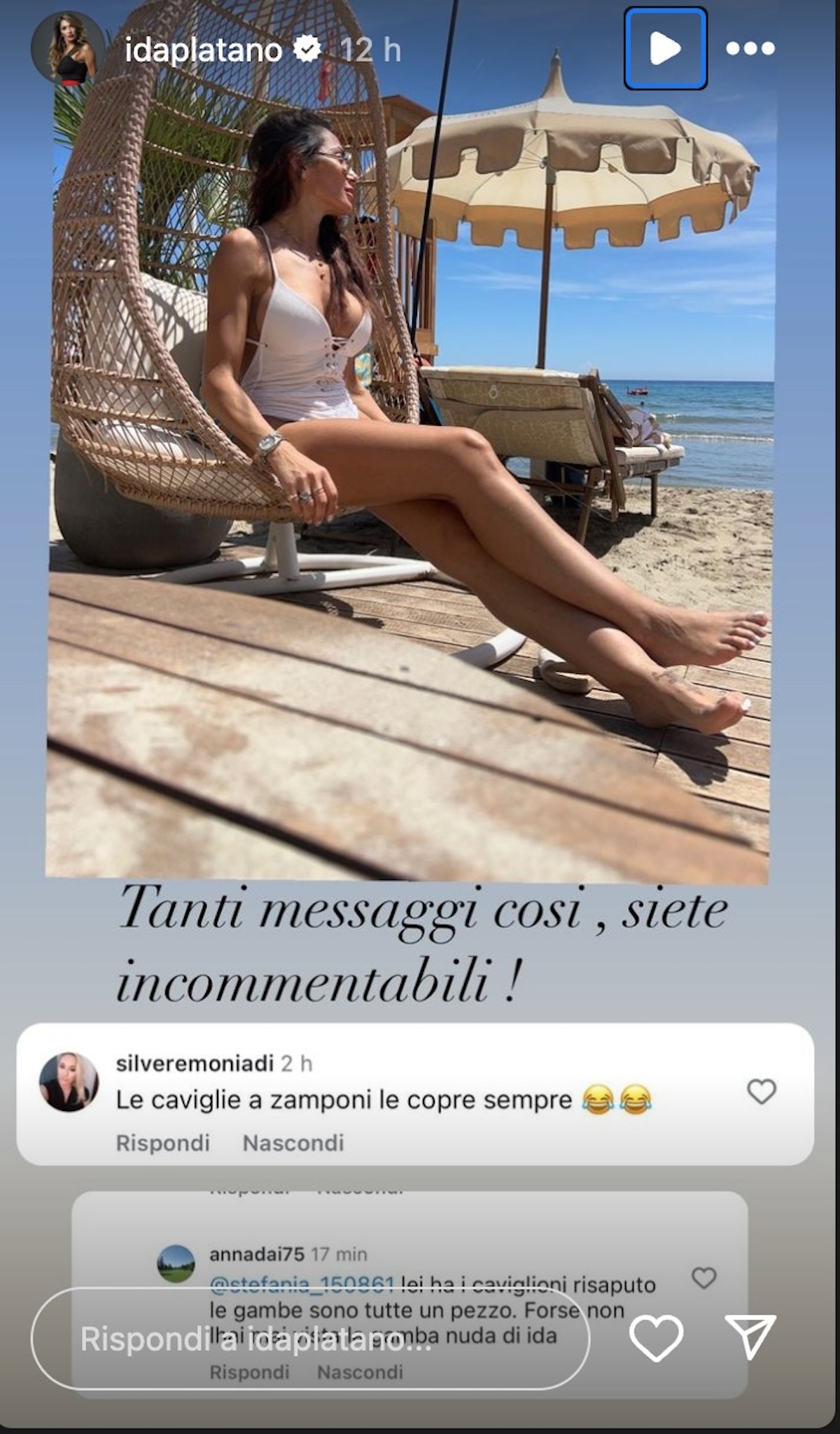 Ida Platano insultata per una foto: "Vi spiego perchè le mie gambe sono diventate così"